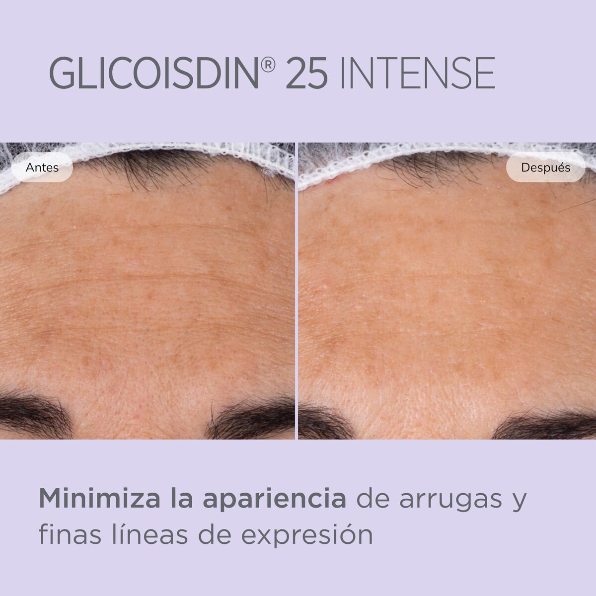 Isdin Isdinceutics Glicoisdin 25 Gel Facial 50 g