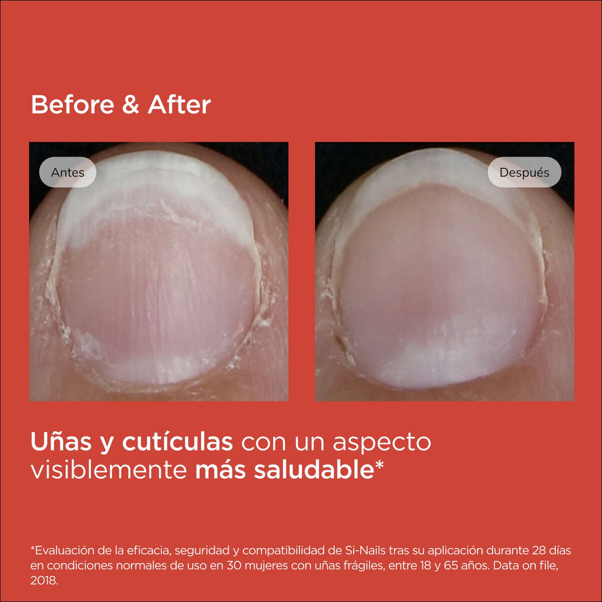 Isdin SI-Nails Fortalecedor de Uñas 2,5 ml