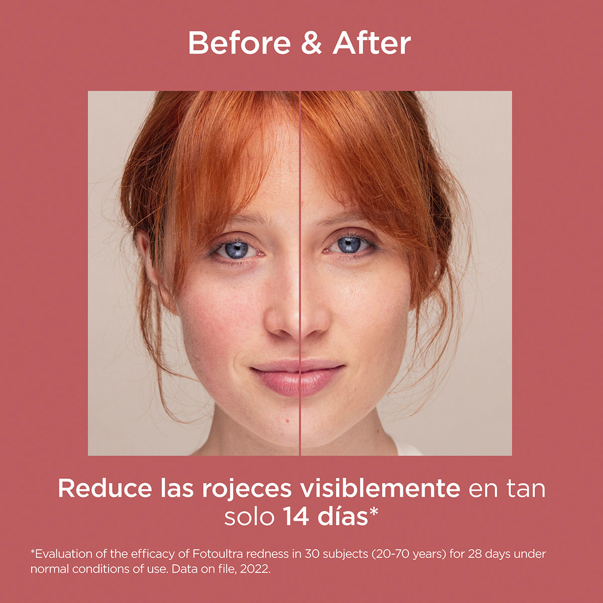 Isdin FotoUltra Redness SPF+50 Pieles Rojas 50 ml